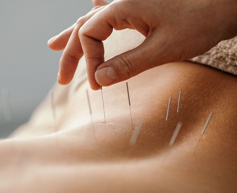 physiotherapy